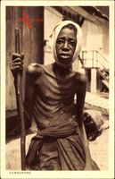 Lambaréné Gabun, Kranker Afrikaner, Unterernährung